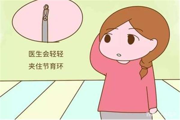 月经干净一天可以取环吗